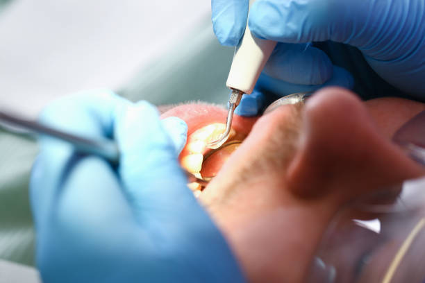 Best After-Hours Emergency Dentist in Roland, AR