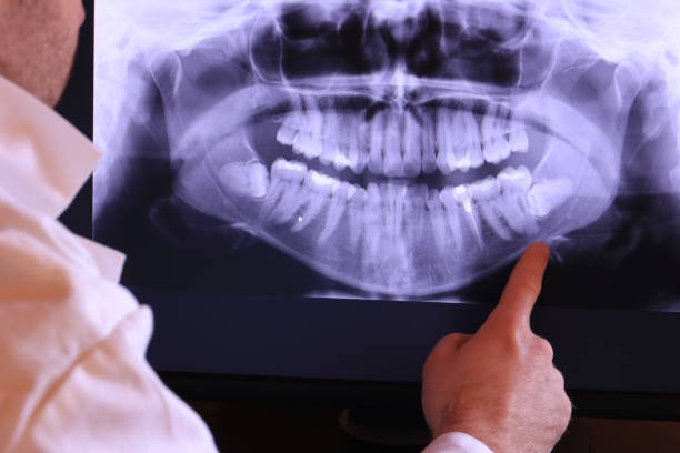 Best Emergency Wisdom Teeth Removal in Roland, AR