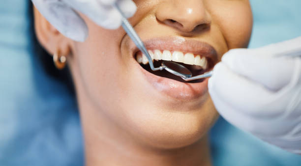 Best Emergency Tooth Extraction in Roland, AR